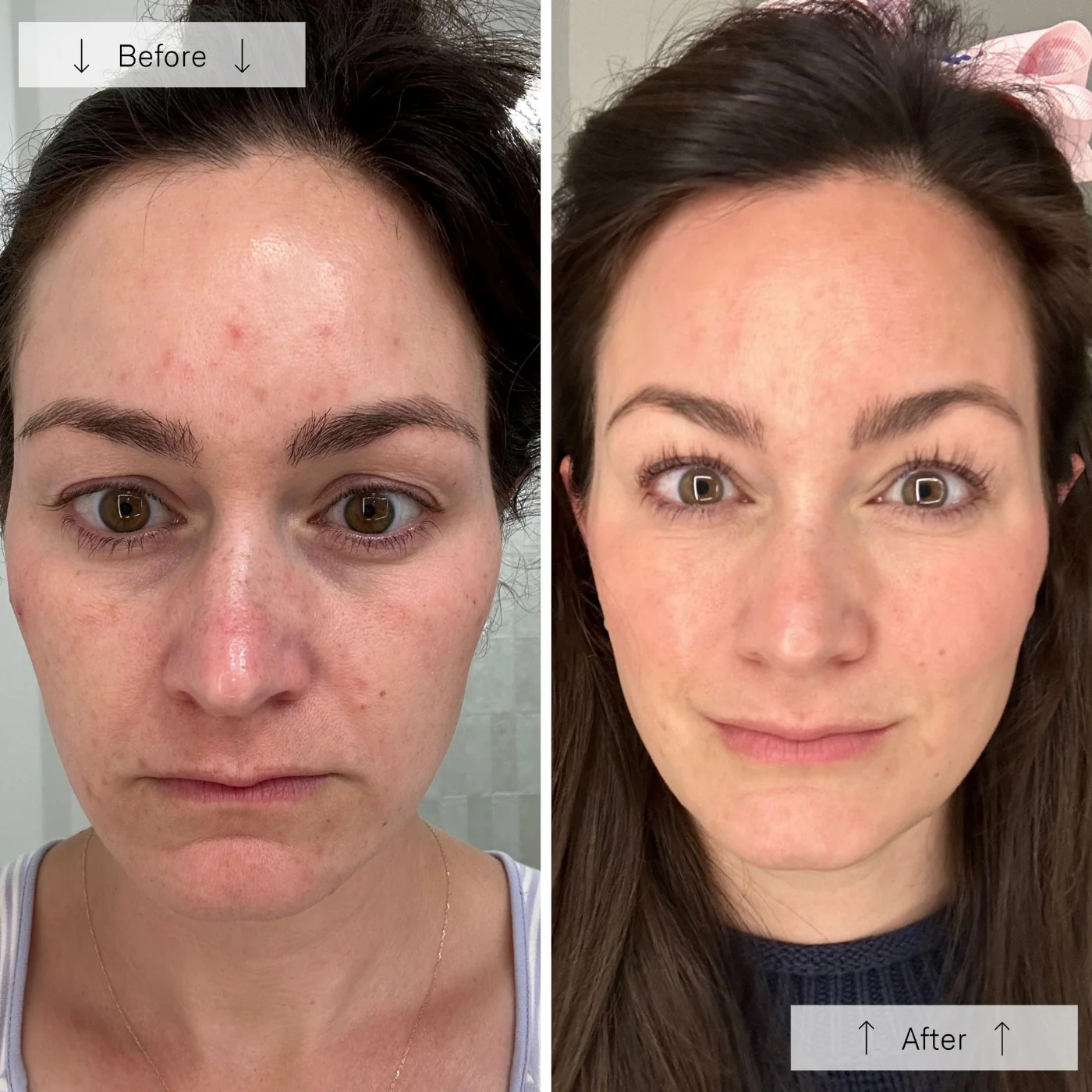 Contour_Face_BA_1