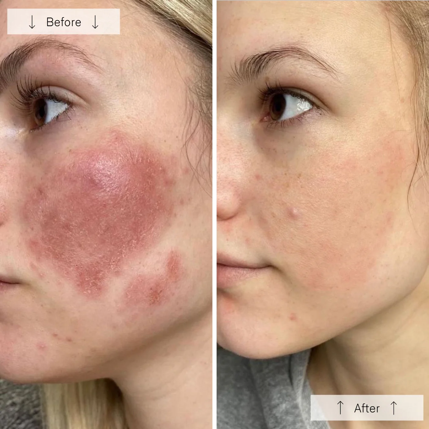 Contour_Face_BA_2